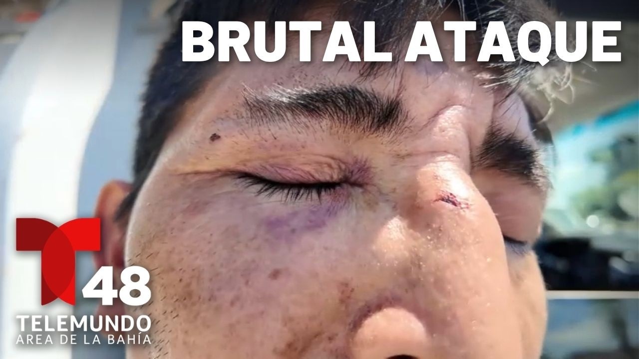 Agreden brutalmente a 2 vendedores en el Muelle 39 en San Francisco Agreden brutalmente a 2 vendedores en el Muelle 39 en San Francisco