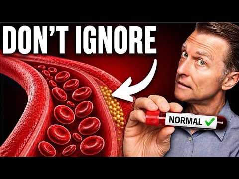50% of Heart Attack Victims Had “Normal” Lab Results