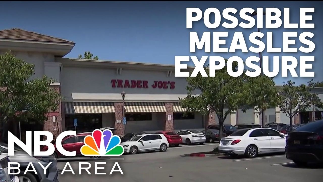 Possible measles exposure in three Bay Area locations Possible measles exposure in three Bay Area locations