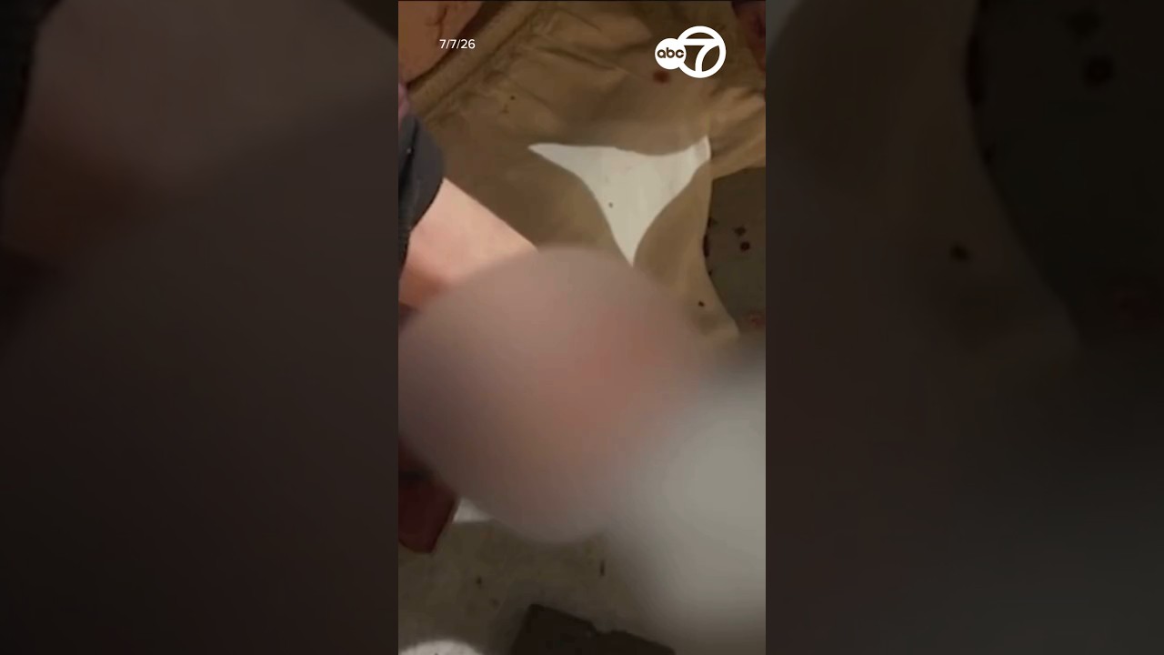 Multiple people lose eyes, hands in illegal fireworks-related injuries in SF Multiple people lose eyes, hands in illegal fireworks-related injuries in SF